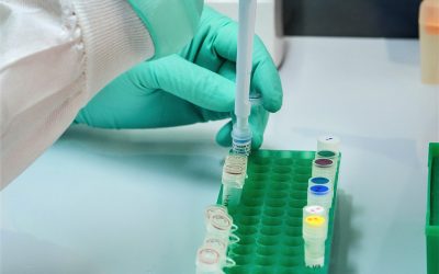 Should I get a stool test for IBS?