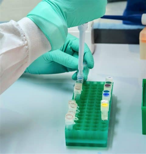 Should I get a stool test for IBS? - Goodness Me Nutrition Should I get a stool test for IBS? - Goodness Me Nutrition