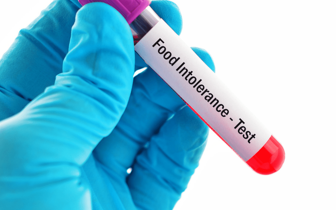 IgG food Intolerance test – Should I get a test for IBS?