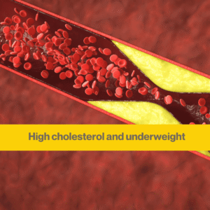 realistic image of the inside of a vein showing blood flowing through, with a narrowing of the tube due to coronary plaque. Words High cholesterol and underweight.